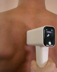 IPL Elysea – Premium Haarentfernungsgerät | Permanente Haarreduktion für Zuhause